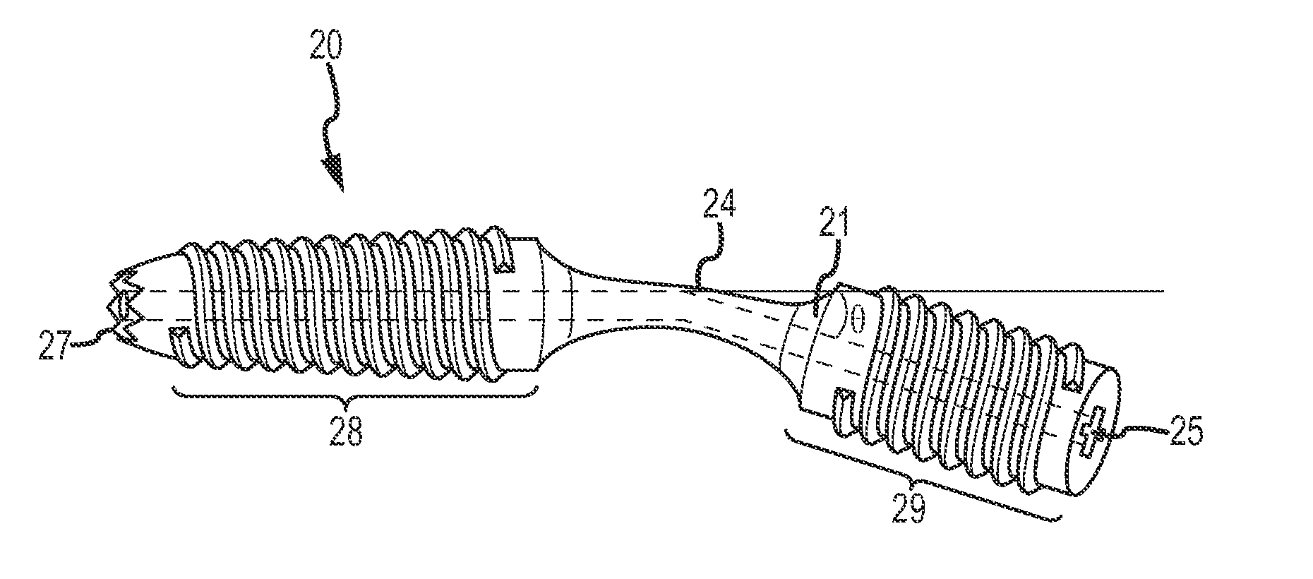 Bent dip fusion screw