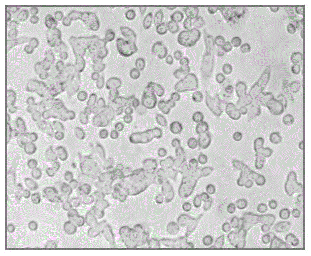 A kind of human lung adenocarcinoma cell line and application thereof