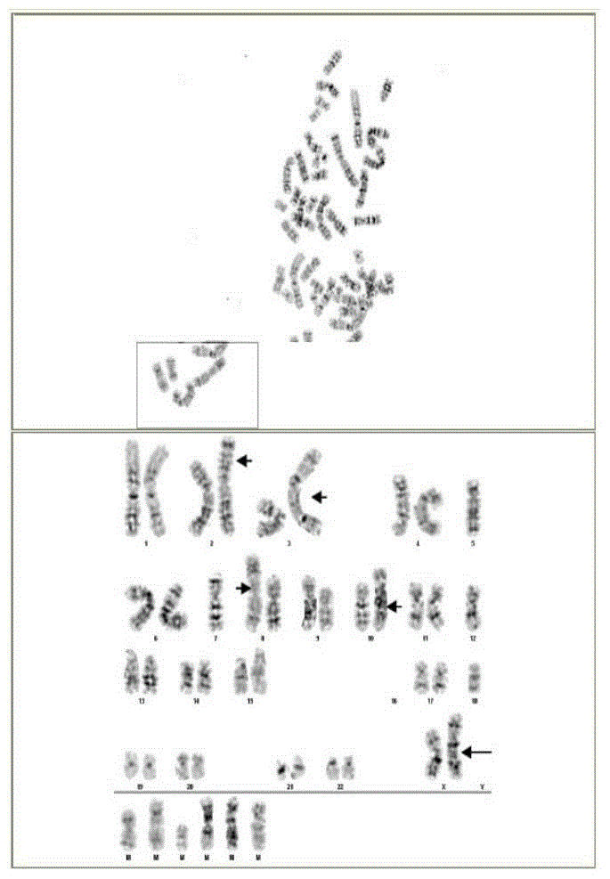 A kind of human lung adenocarcinoma cell line and application thereof