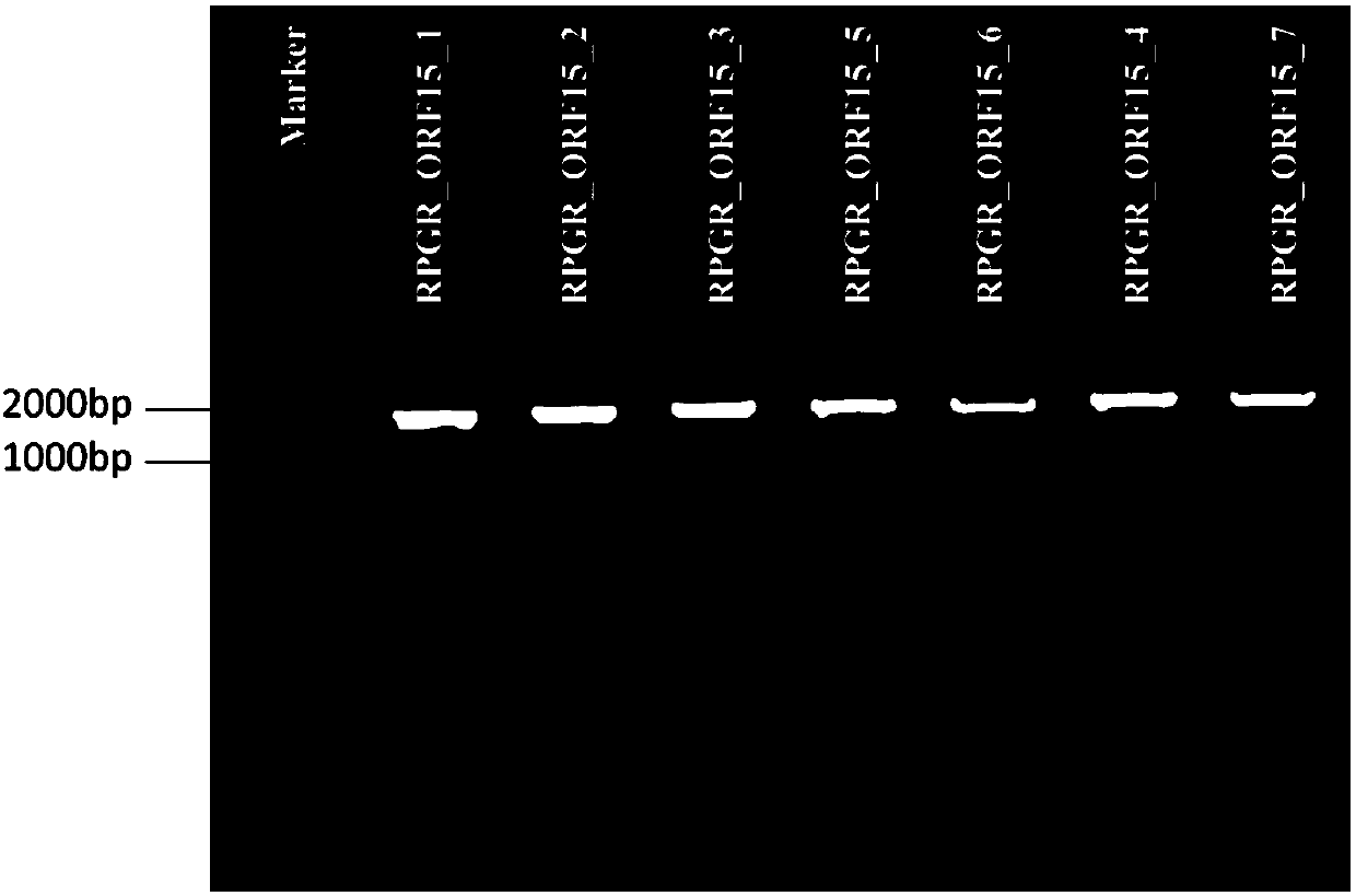 Method and primer for detecting mutation of ORF15 exon of RPGR gene