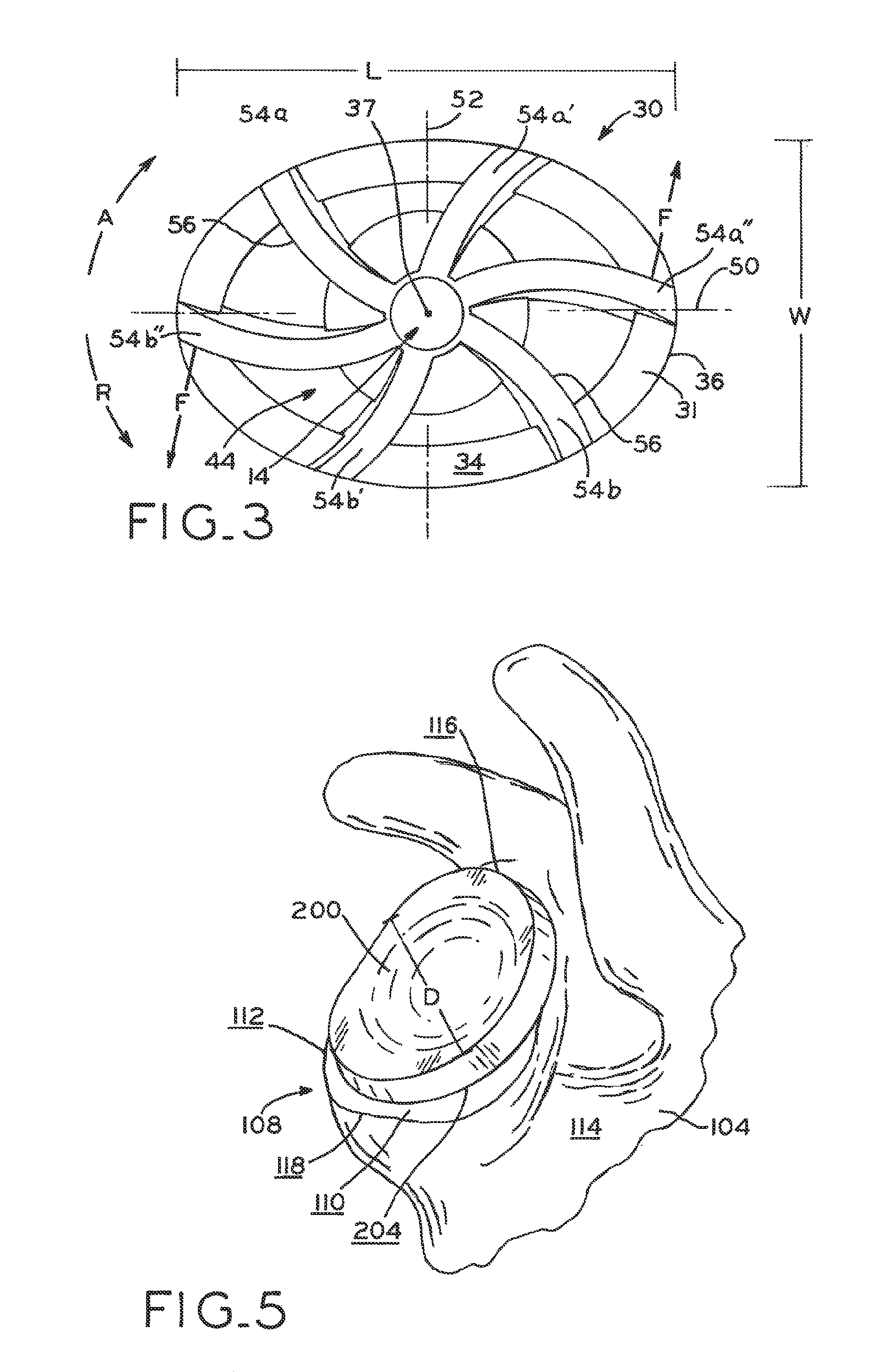 Orthopaedic reamer