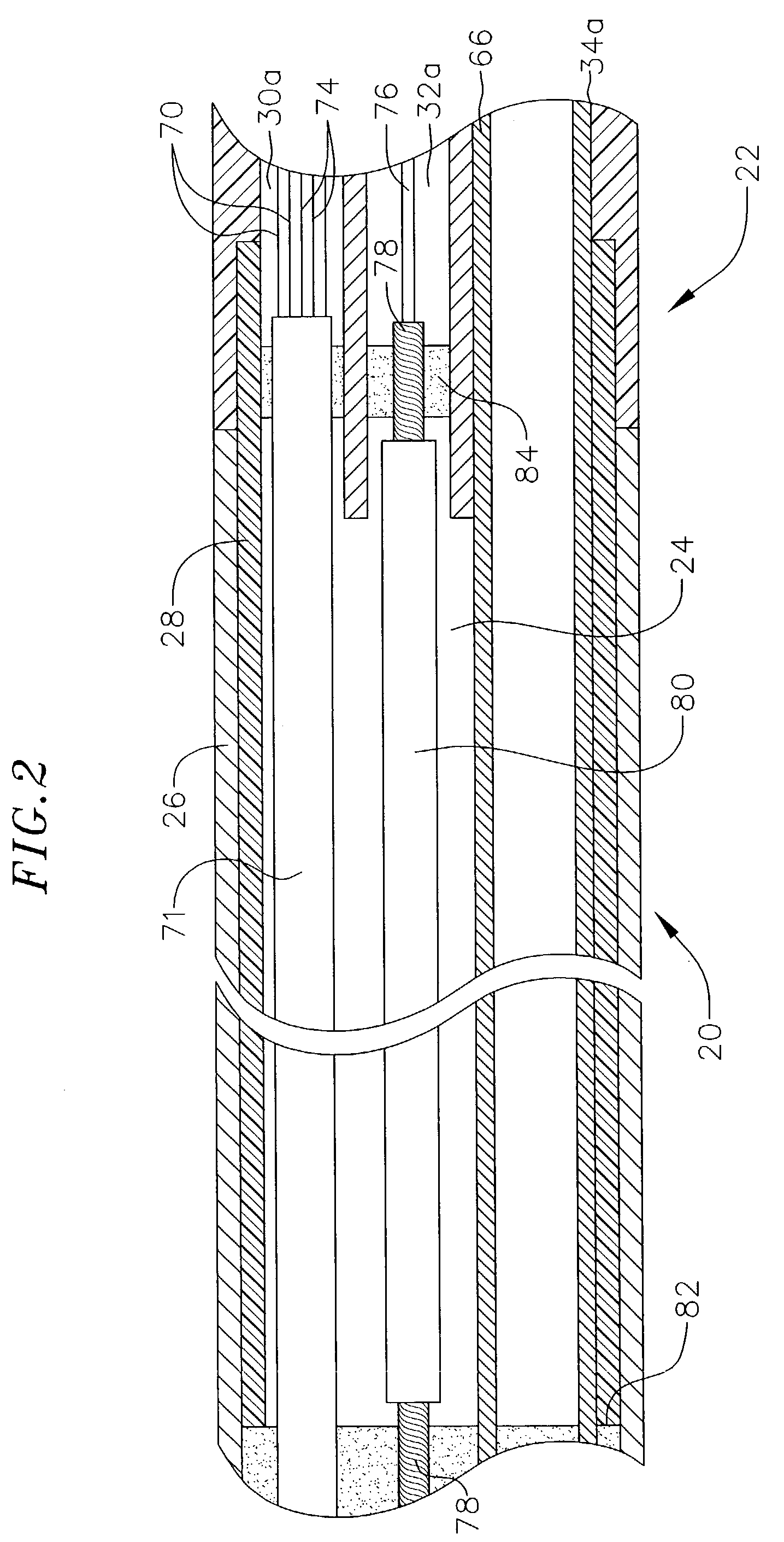 Deflectable catheter with hinge