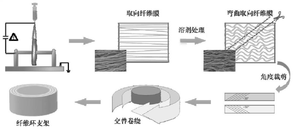 A kind of bionic fibrous ring support and preparation method thereof