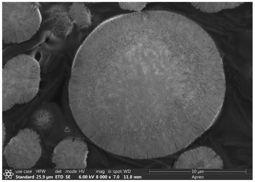 Al/La co-doped high-nickel ternary precursor with core-shell structure and preparation method thereof, and positive electrode material