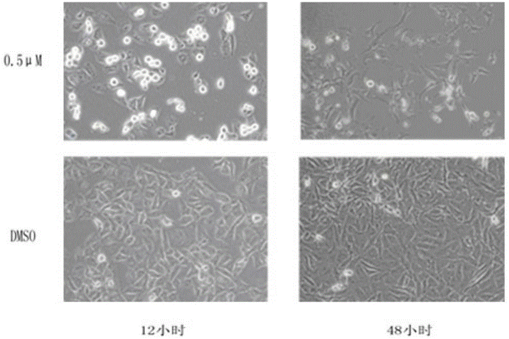 Application of pyrazole hydrazone derivative in preparation of anti-breast cancer drug