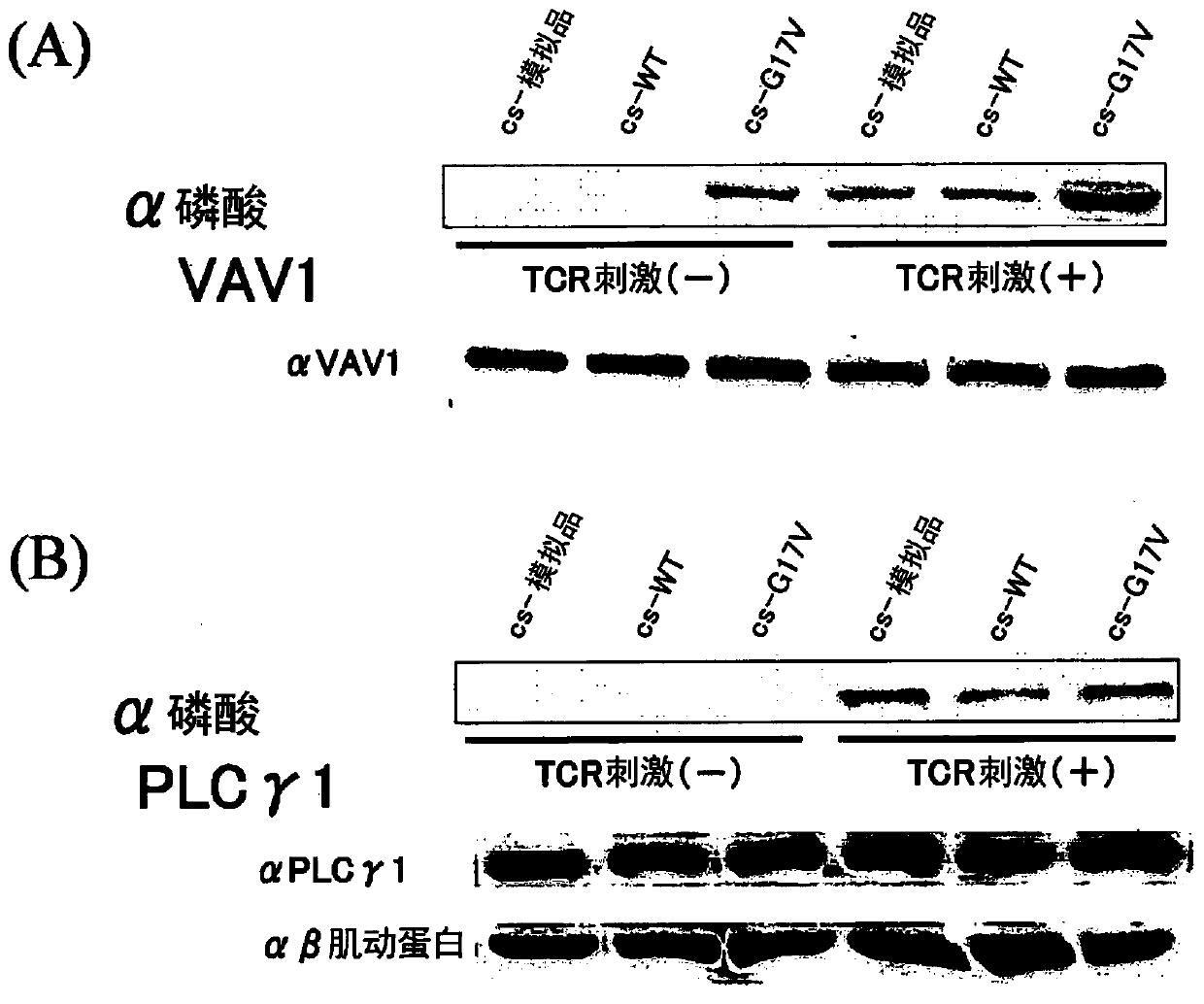 Therapeutic agent for tumors identified by phosphorylation of proto-oncogene protein belonging to vav family