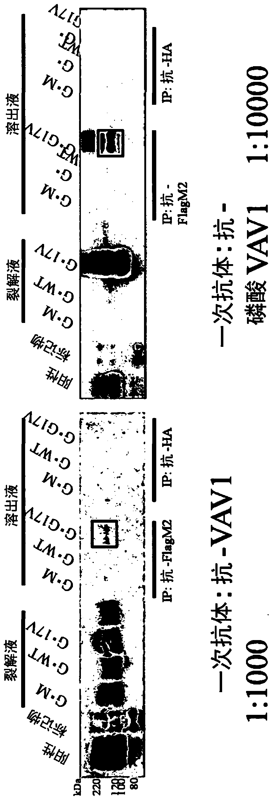 Therapeutic agent for tumors identified by phosphorylation of proto-oncogene protein belonging to vav family