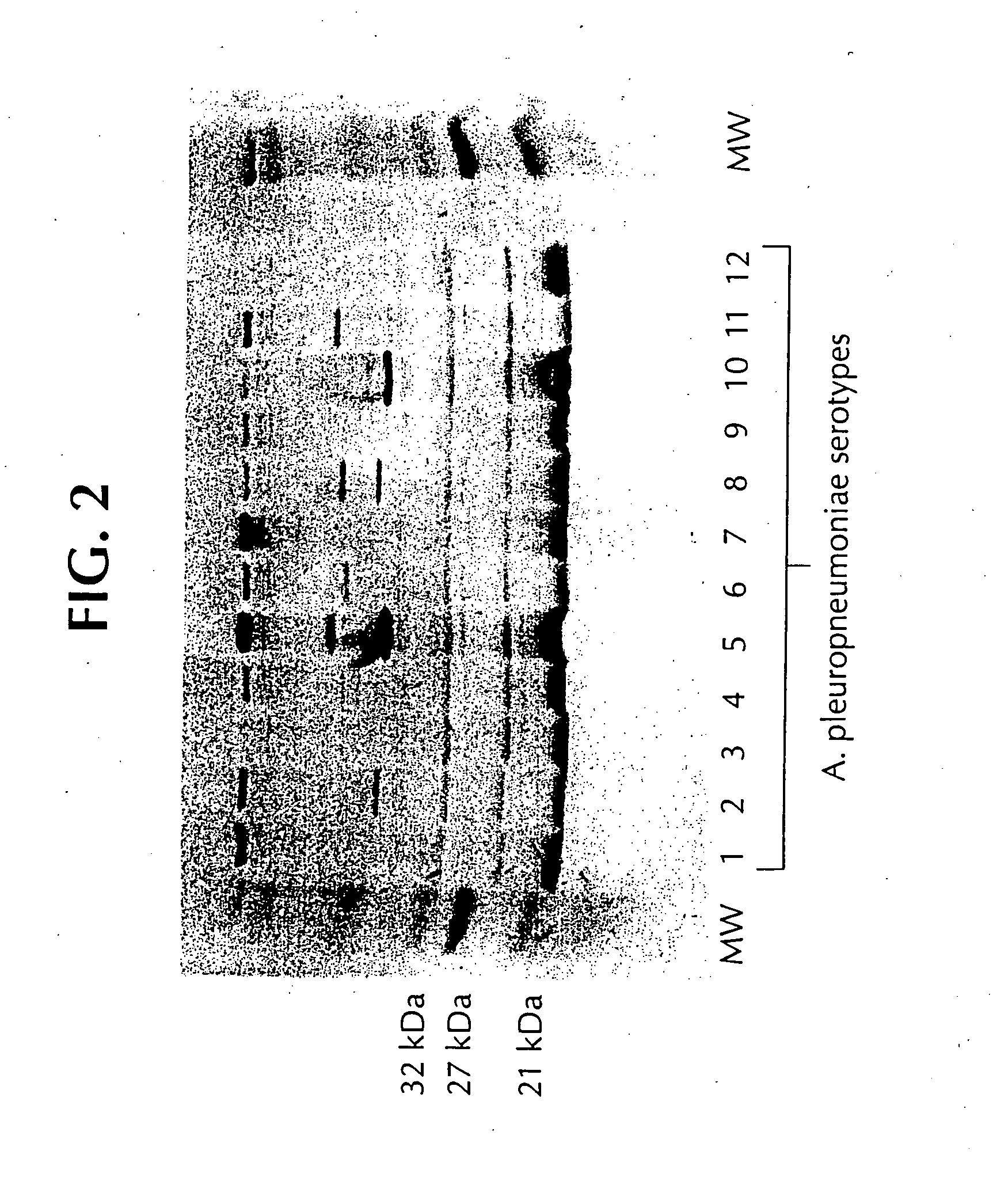 Novel proteins from Actinobacillus pleuropneumoniae