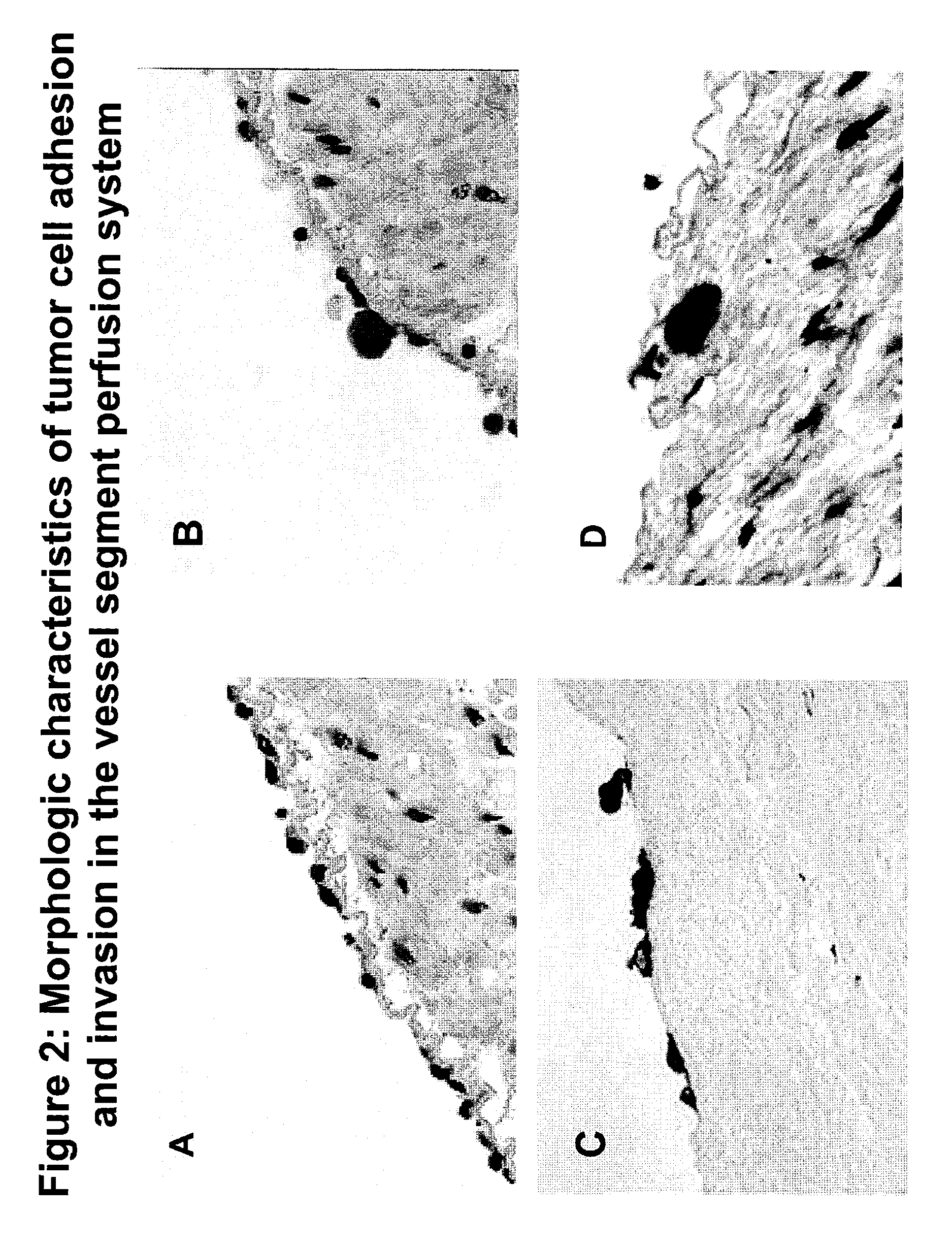 Composition and method for sulfated non-anticoagulant low molecular weight heparins in cancer and tumor metastasis