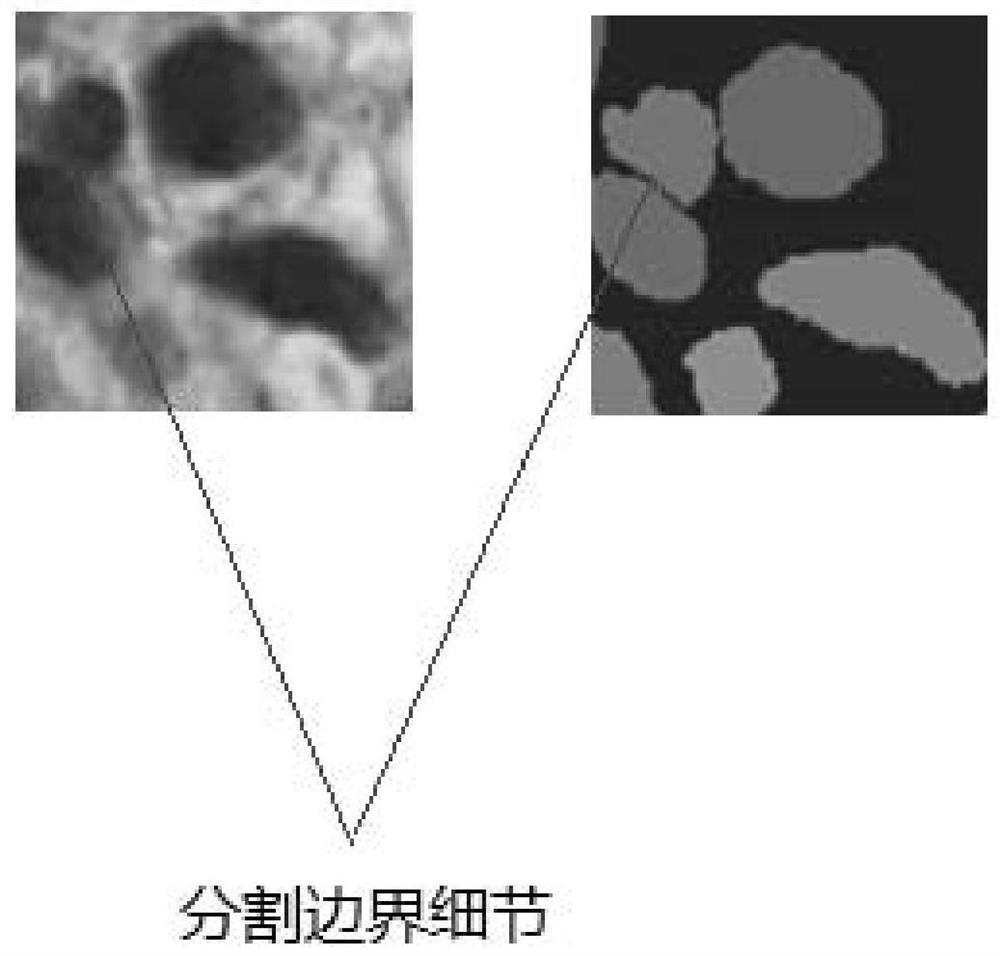 Cell nucleus segmentation method, system and device and cancer auxiliary analysis system and device based on pathological image