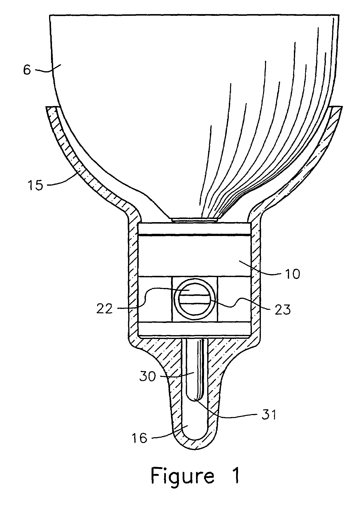 Prosthetic locking device