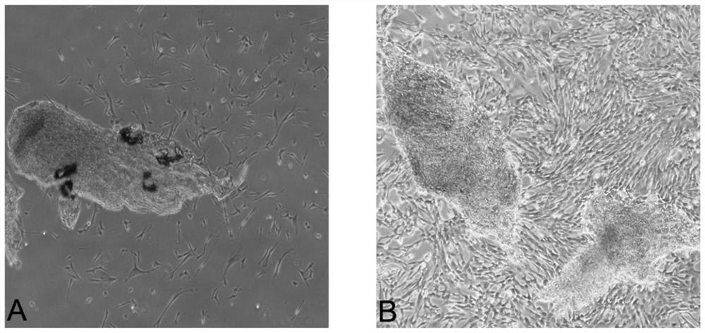 Stem cell exosome composition for treating knee osteoarthritis