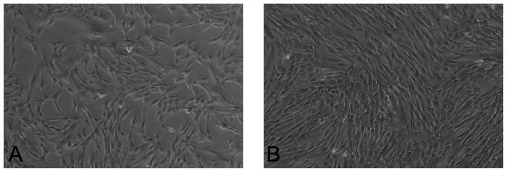 Stem cell exosome composition for treating knee osteoarthritis