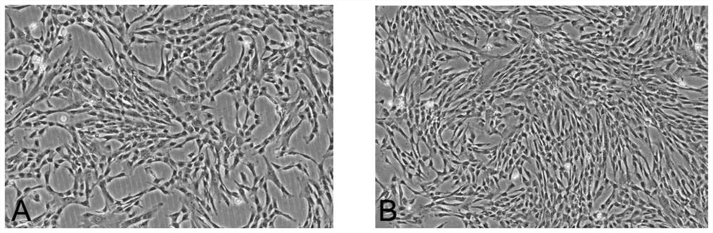 Stem cell exosome composition for treating knee osteoarthritis