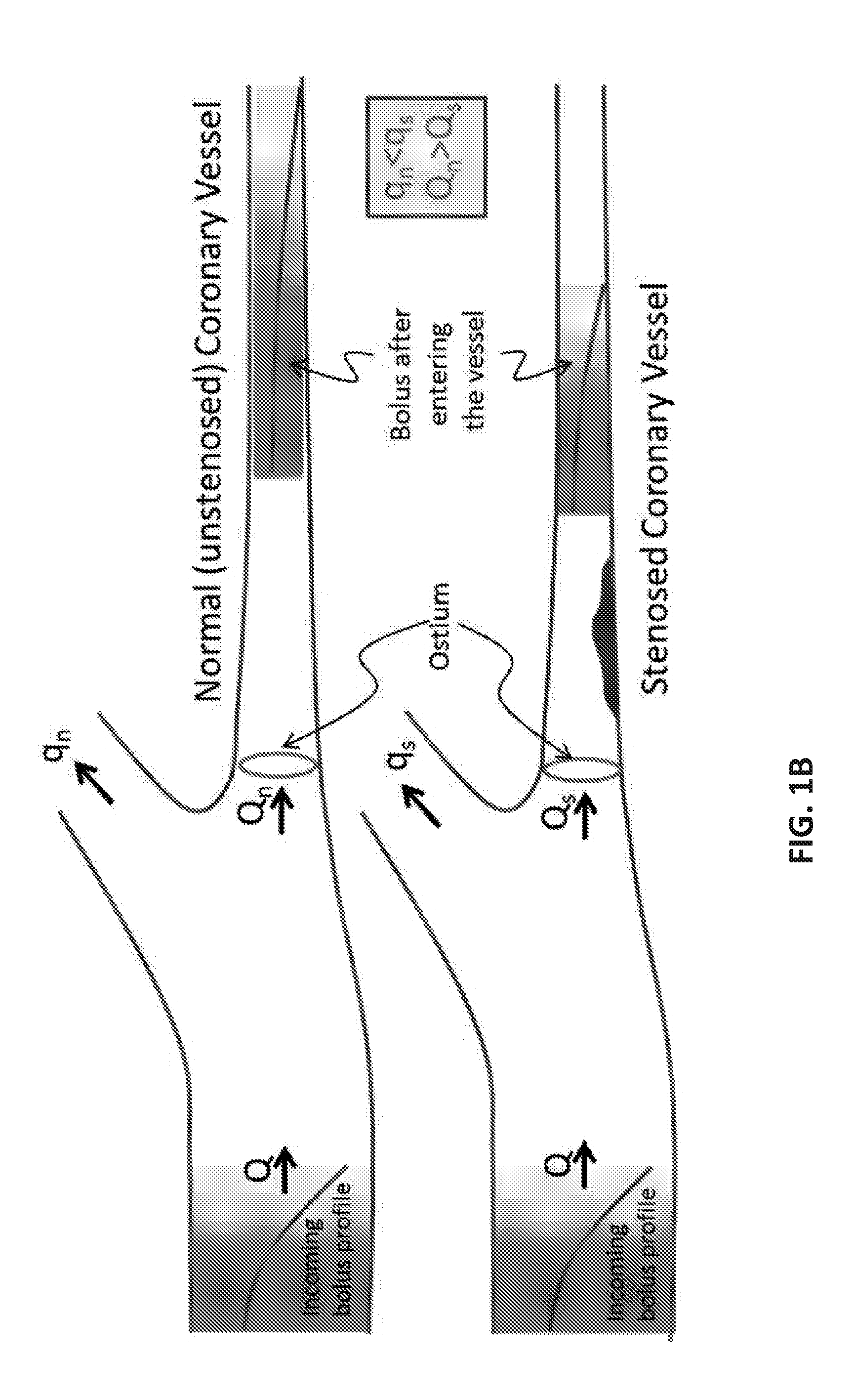 Method for Estimating Flow Rates, Pressure Gradients, Coronary Flow Reserve, and Fractional Flow Reserve from Patient Specific Computed Tomography Angiogram-Based Contrast Distribution Data