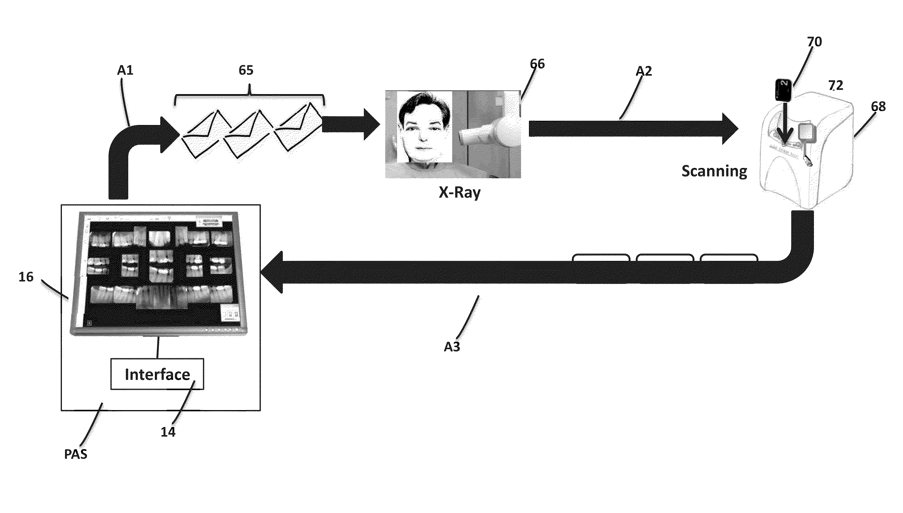 Computed radiography license method and system