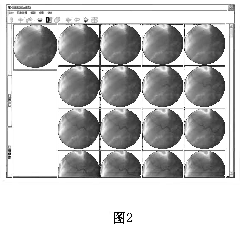 Method for eliminating motion artifacts in digital subtraction angiography and system thereof