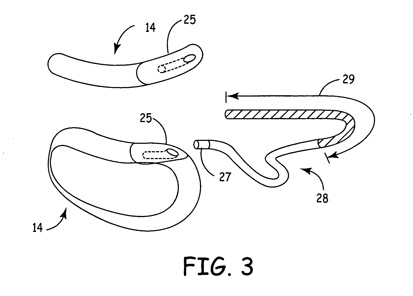 Remotely enabled pacemaker and implantable subcutaneous cardioverter/defibrillator system