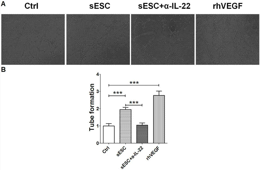 Application of interleukin (IL-22) antibody in preparing medicines for treating adenomyosis