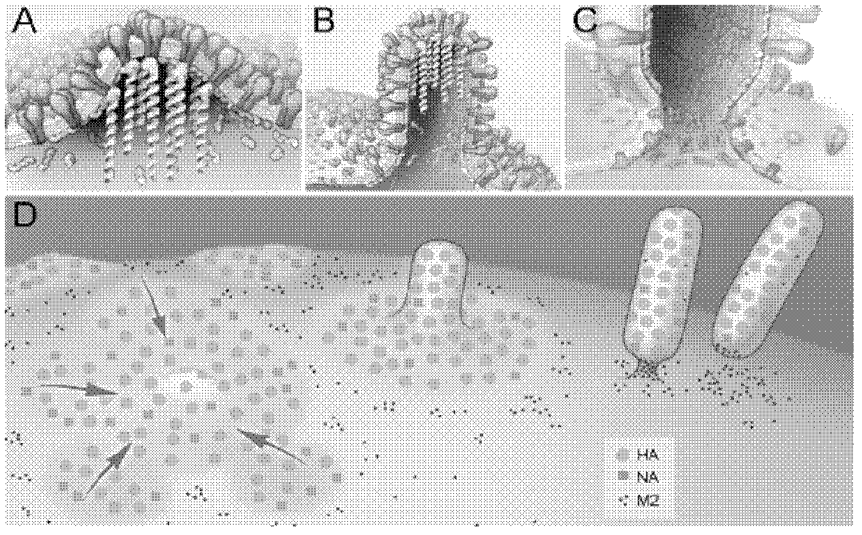 Application of BST-2 protein in preparing medicaments for treating diseases caused by influenza A virus