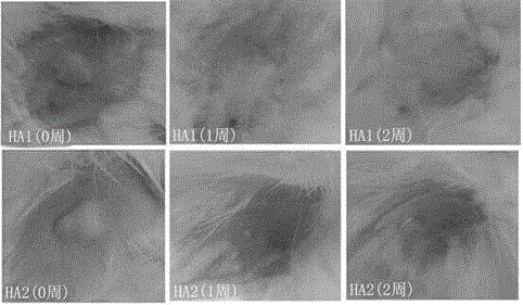 Preparation method of polysialic acid-hyaluronic acid composite gel, obtained product and application