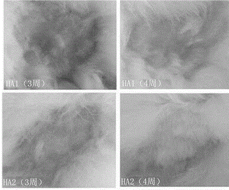 Preparation method of polysialic acid-hyaluronic acid composite gel, obtained product and application