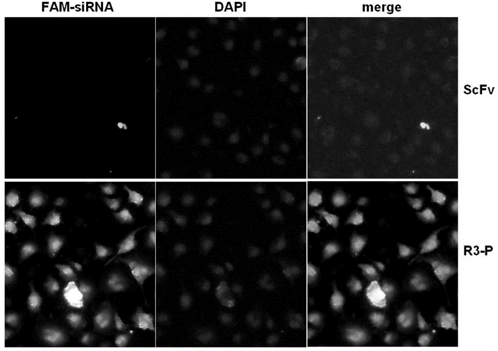 FGFR3 single-chain antibody-protamine fusion protein and application thereof