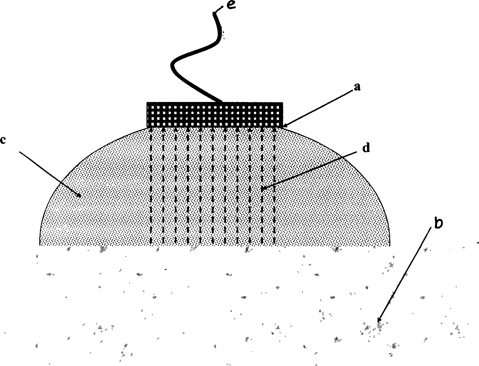 Electrical impedance scanning-projection imaging method for early diagnosis of mammary gland mass