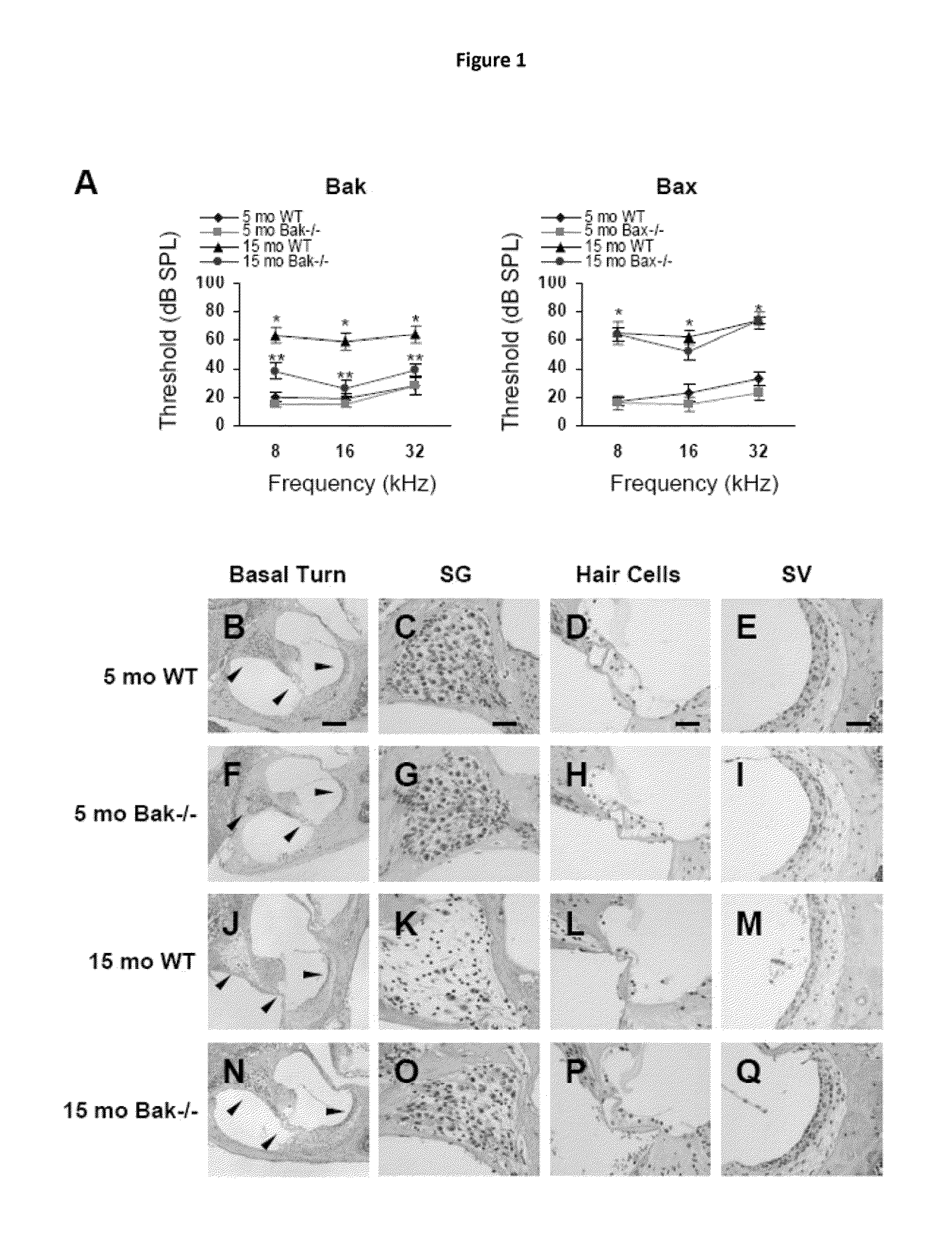 Compositions and methods for preventing and treating presbycusis