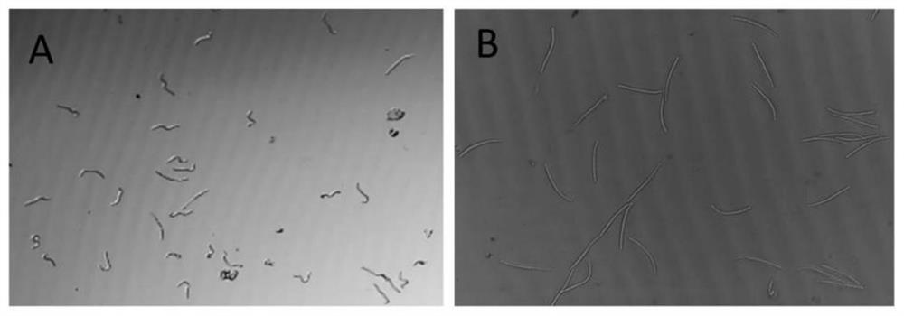 Application of triclosan in preparation of medicine for killing parasitic nematodes