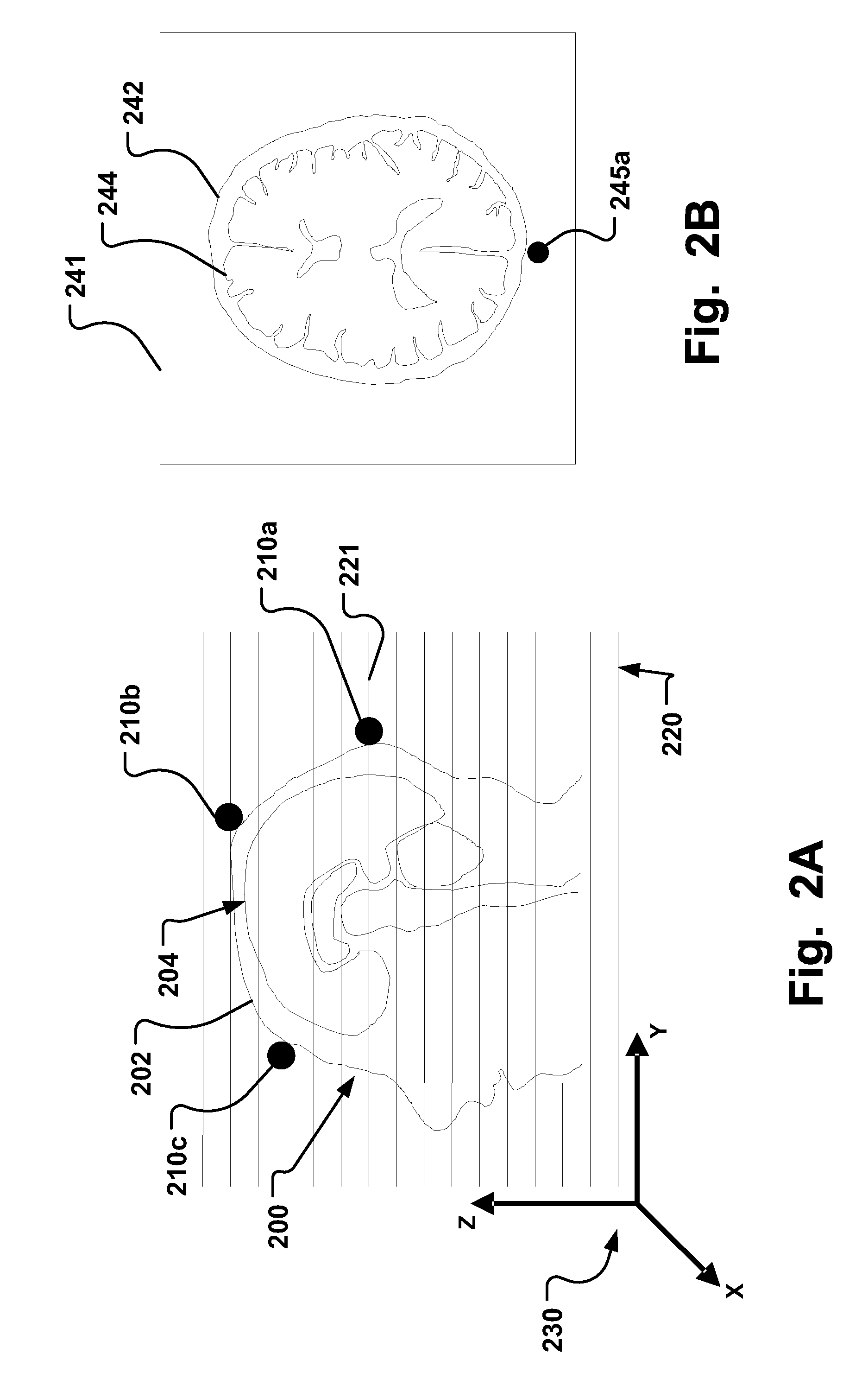 Stereotactic therapy system