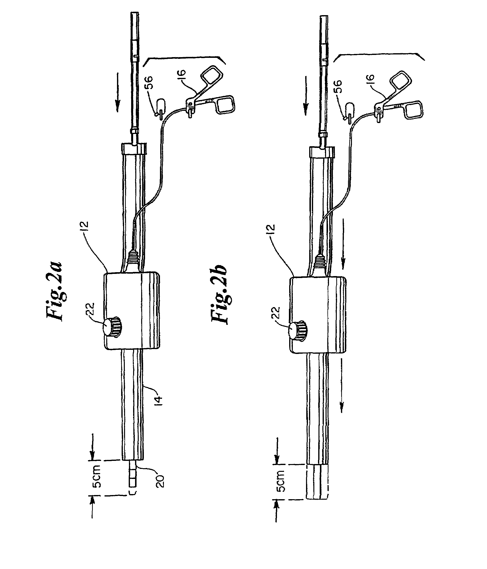 Apparatus and method for vein removal