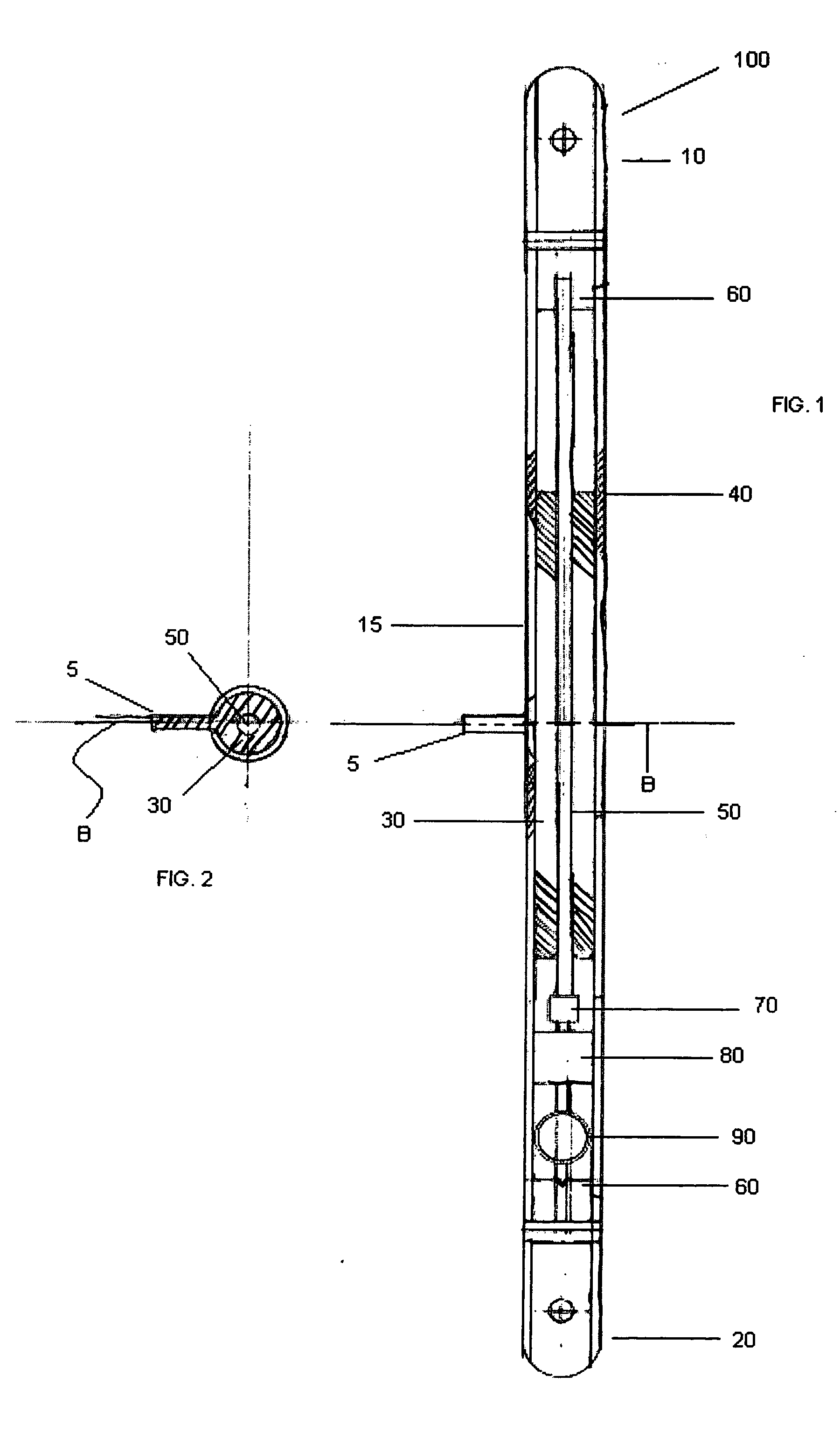 Internal bone transport