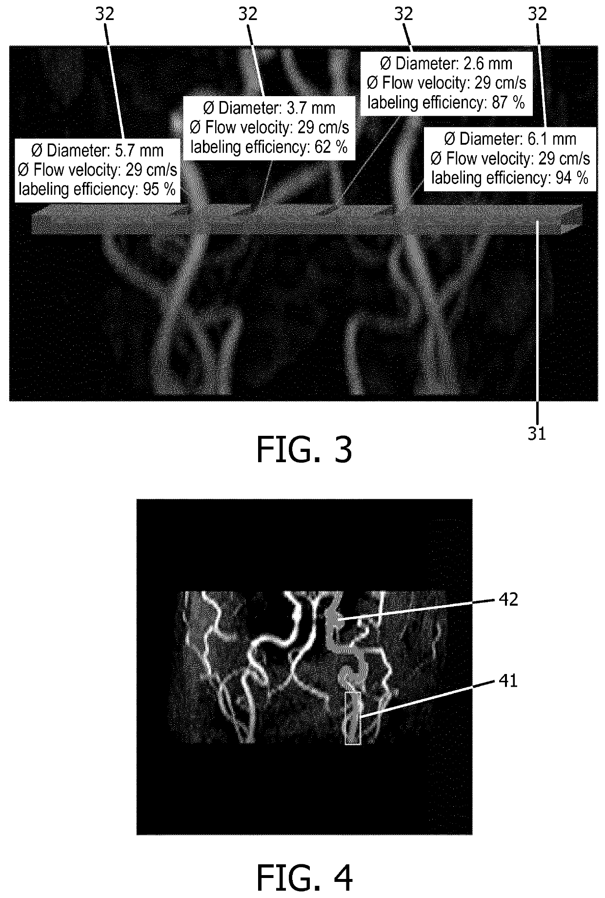 Planning support for selective arterial spin labeling mr imaging methods