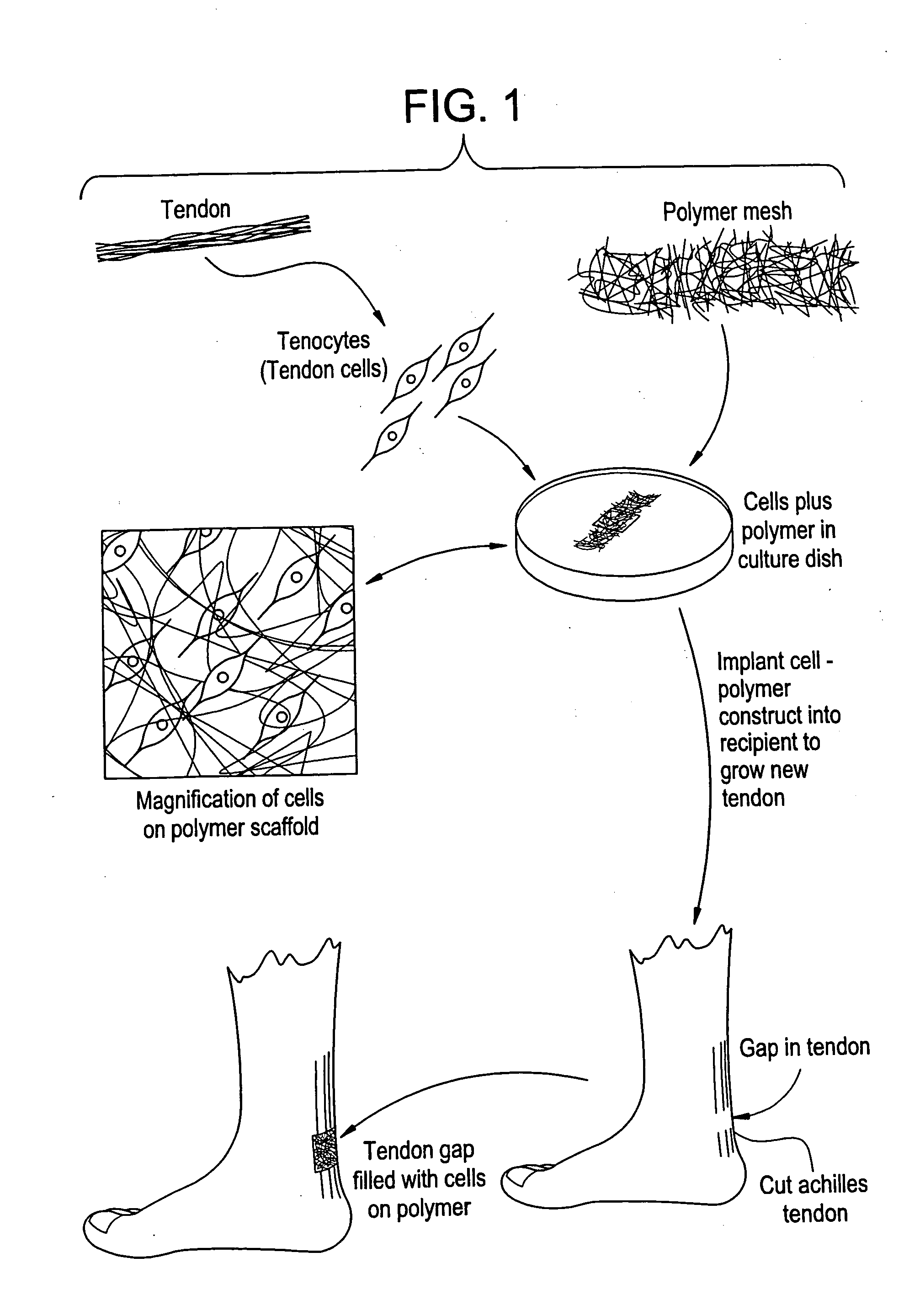 Tissue engineered tendons and ligaments