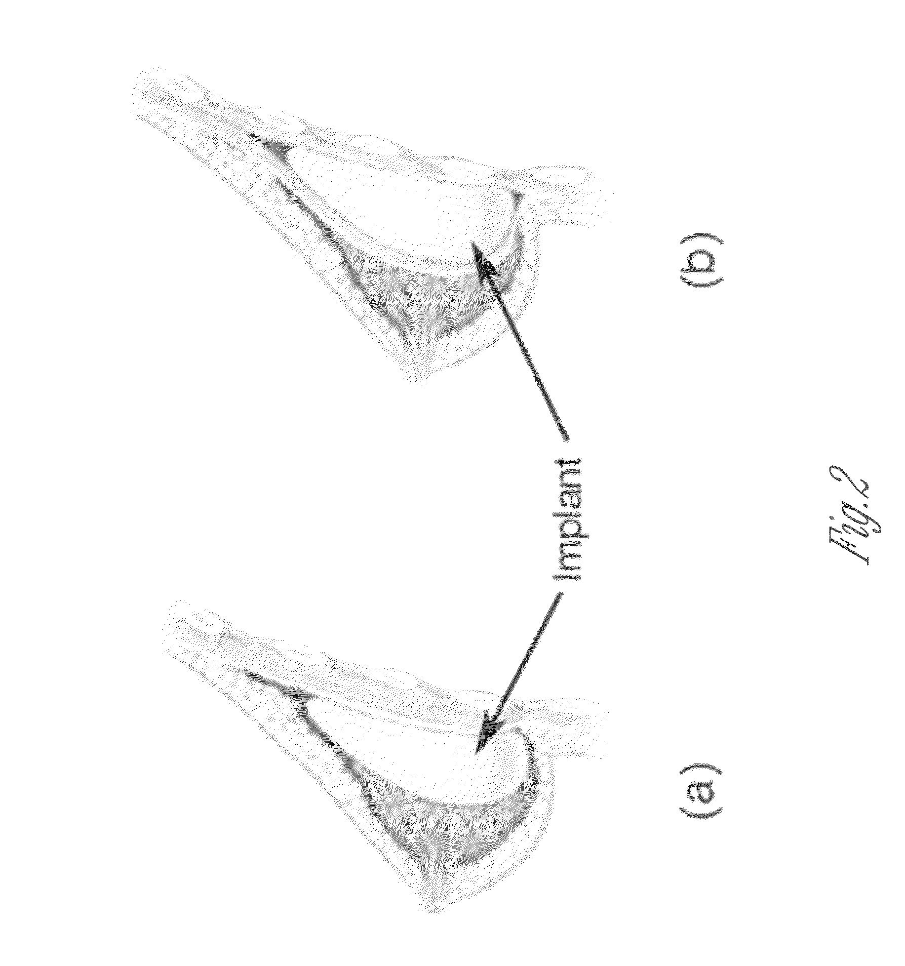 Compositions for breast implant filling and methods of use