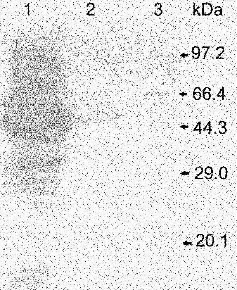 EPSP synthase AroA-Ra multisite mutant of rahnella aquatilis