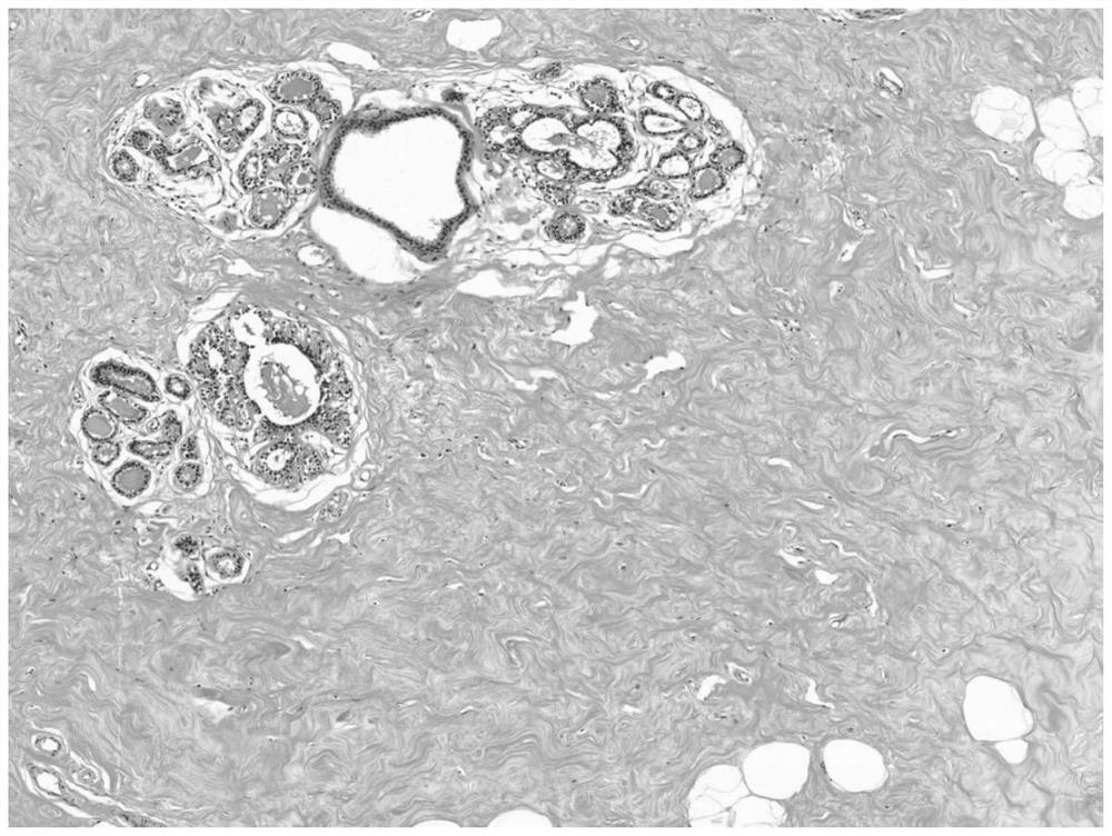 Preparation and staining methods of pathological tissue section staining kit