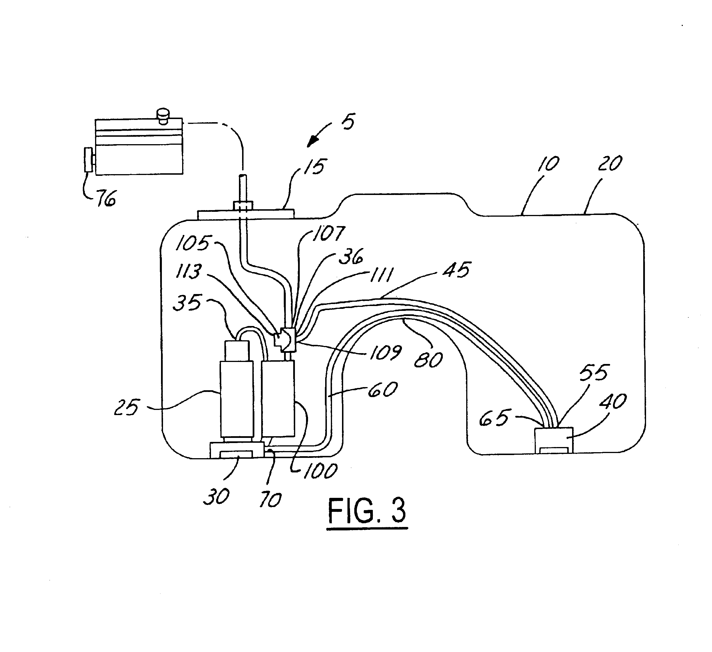 Saddle tank siphon primer