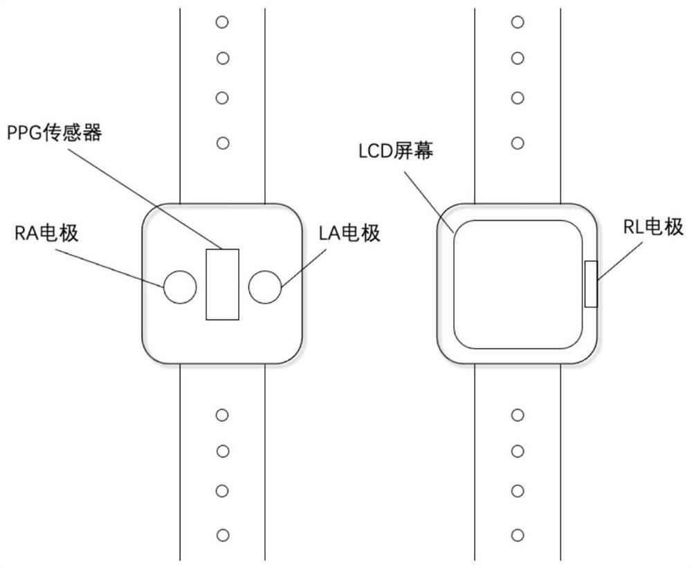 Wristwatch type pulse electrocardio synchronous acquisition and display device