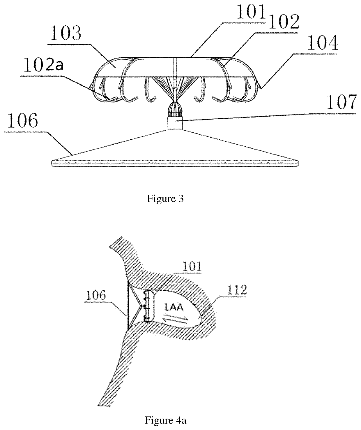 Left atrial appendage closure apparatus