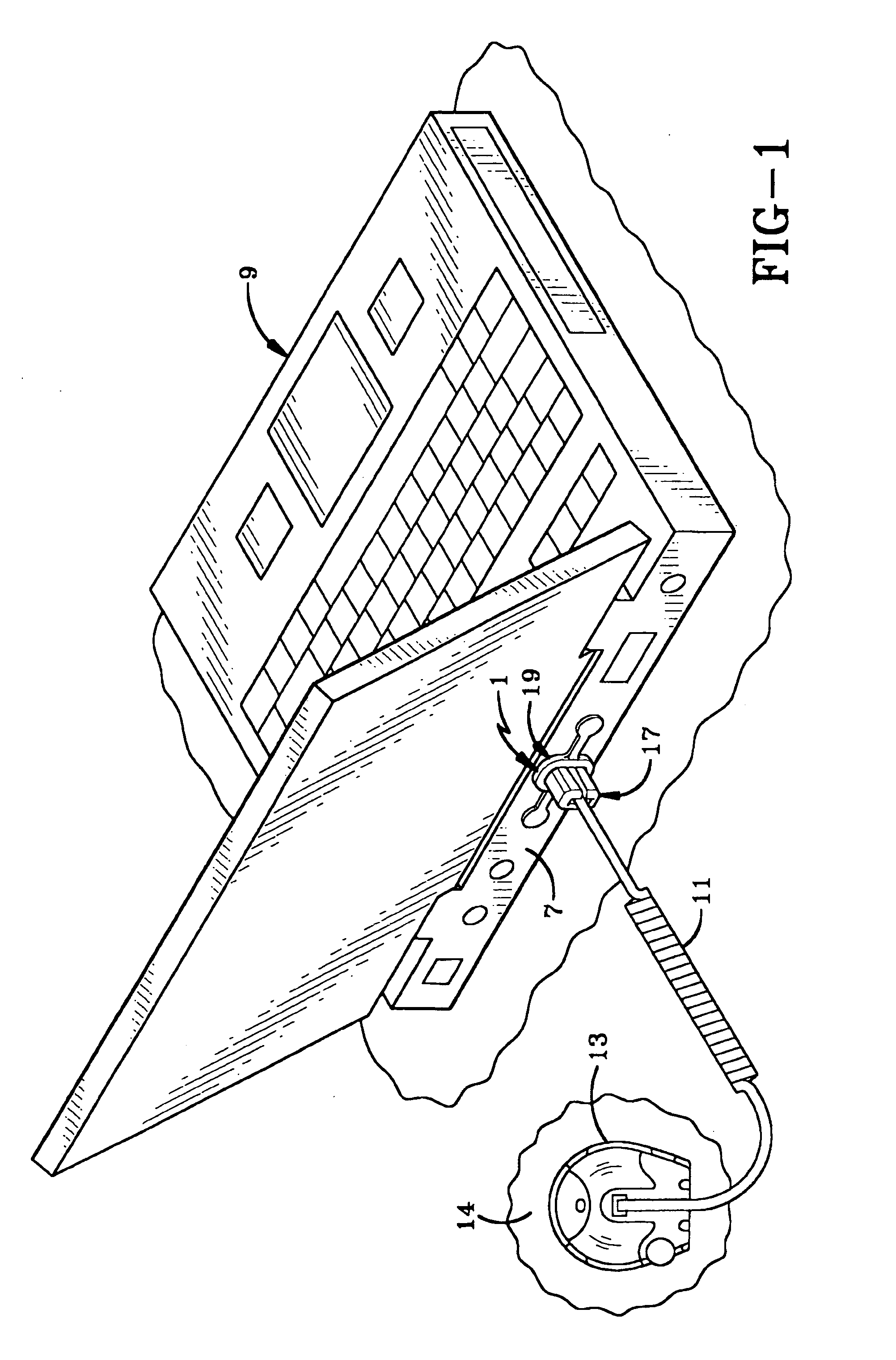 Cable attachment device