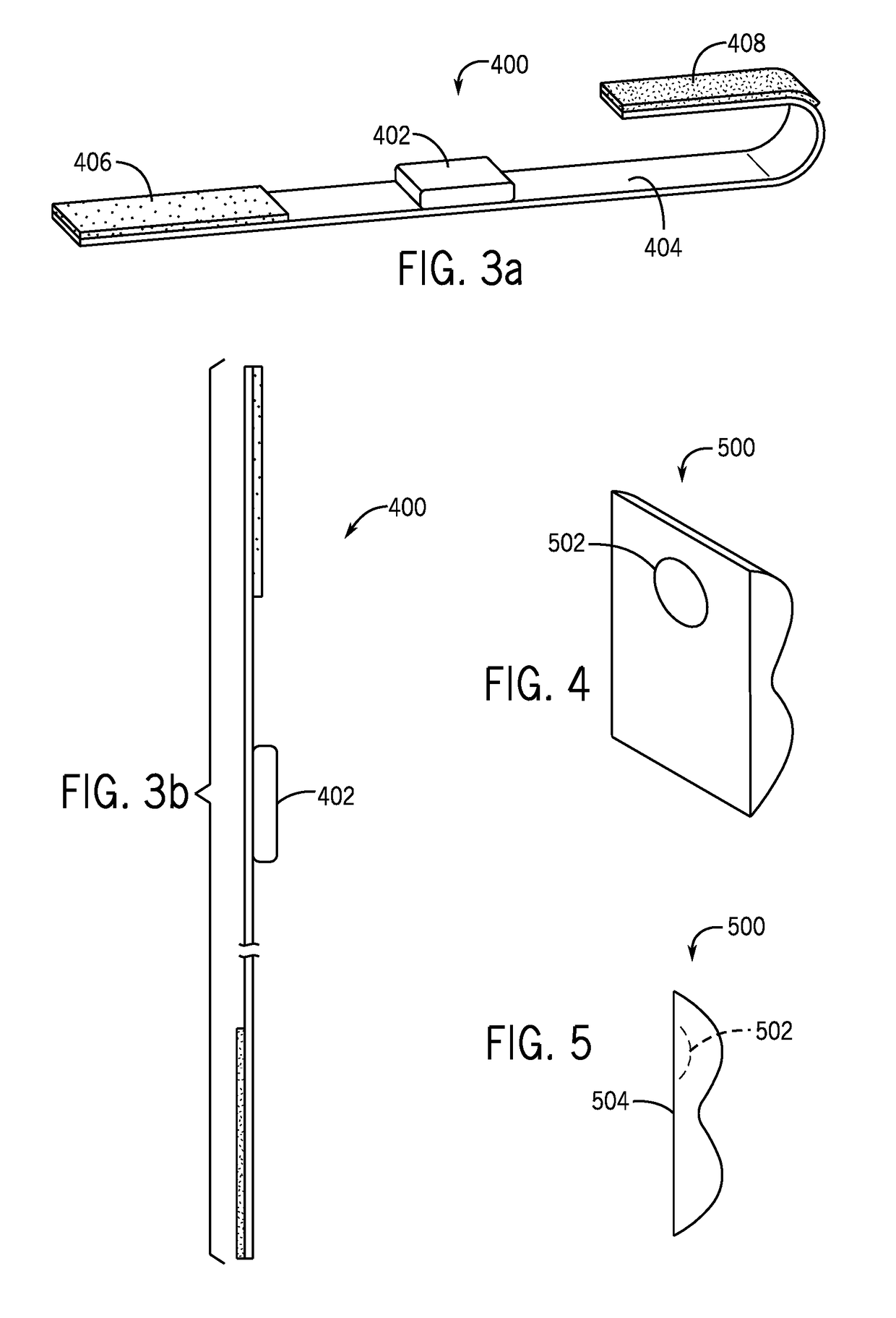 Compression Device and Pressure Sensor for Treatment of Abnormal Upper Esophageal Sphincter Functionality