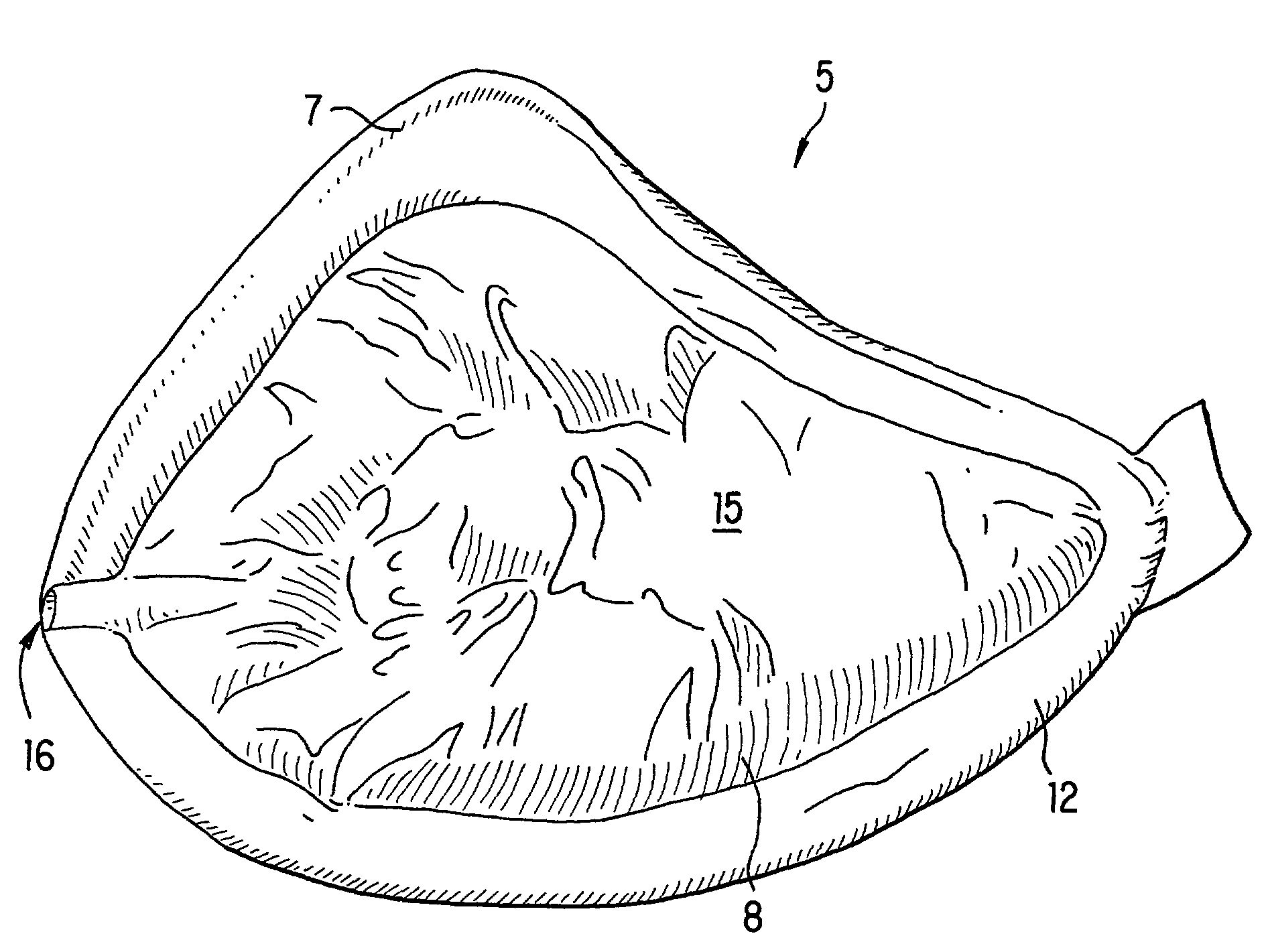 Two-layer external breast prosthesis with self-shaping feature and process for the manufacture thereof