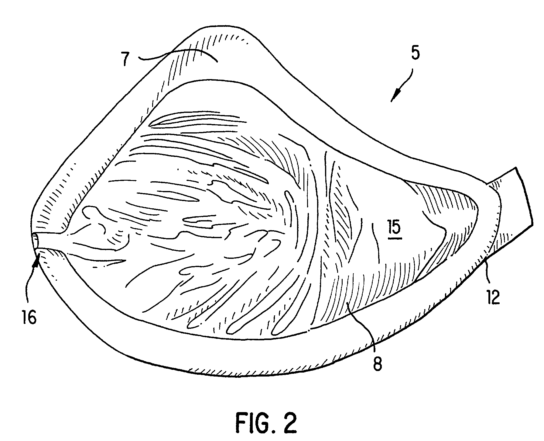 Two-layer external breast prosthesis with self-shaping feature and process for the manufacture thereof