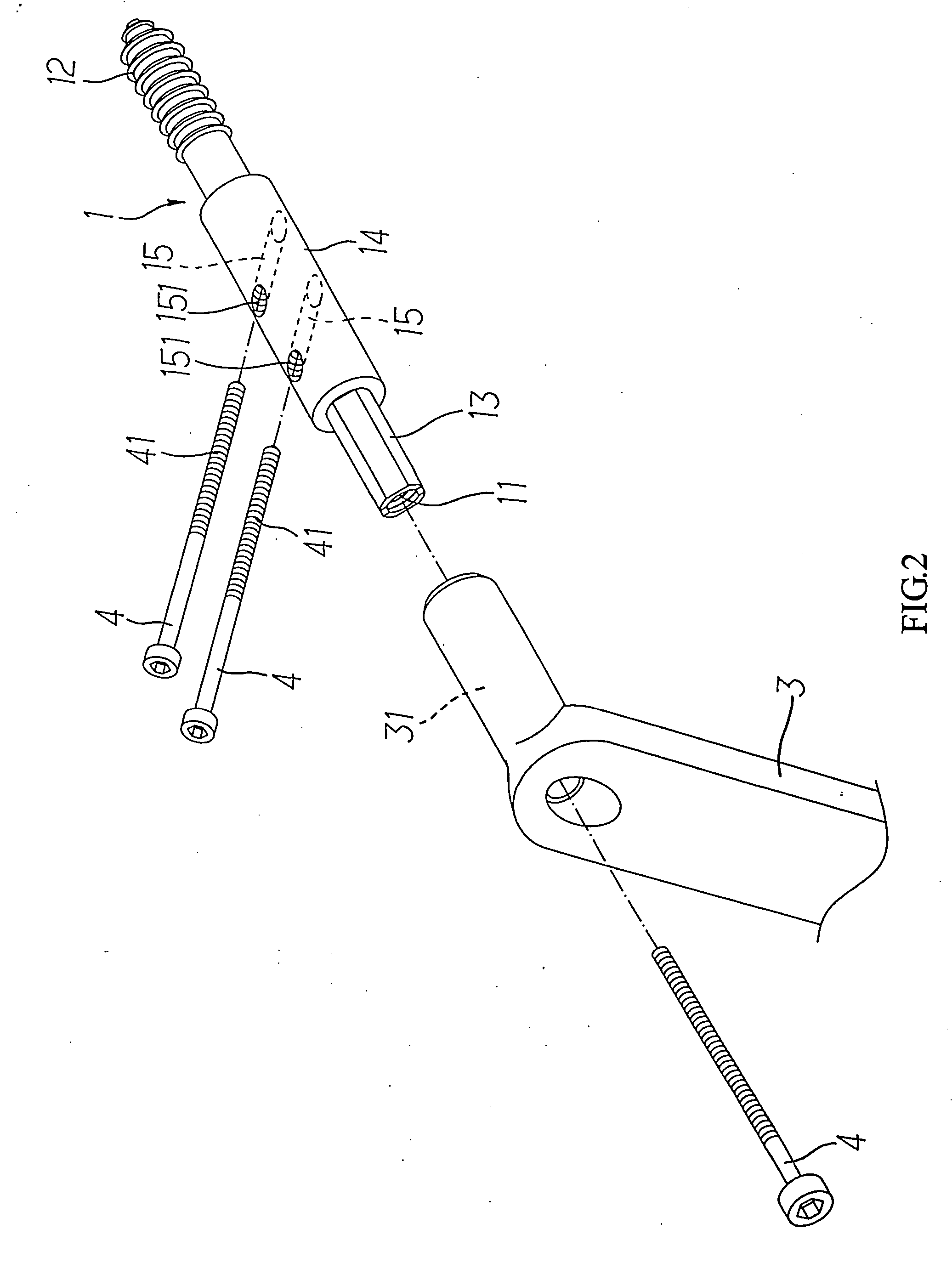 Interlocking hip screw