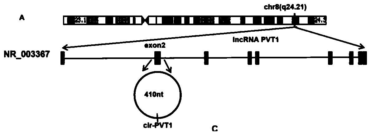 Application of CircRNA PVT1 and peptide fragment in tumor growth prediction, metastasis prediction, prognosis evaluation and treatment