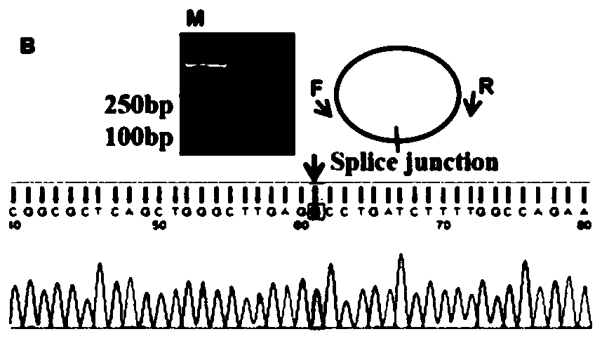 Application of CircRNA PVT1 and peptide fragment in tumor growth prediction, metastasis prediction, prognosis evaluation and treatment