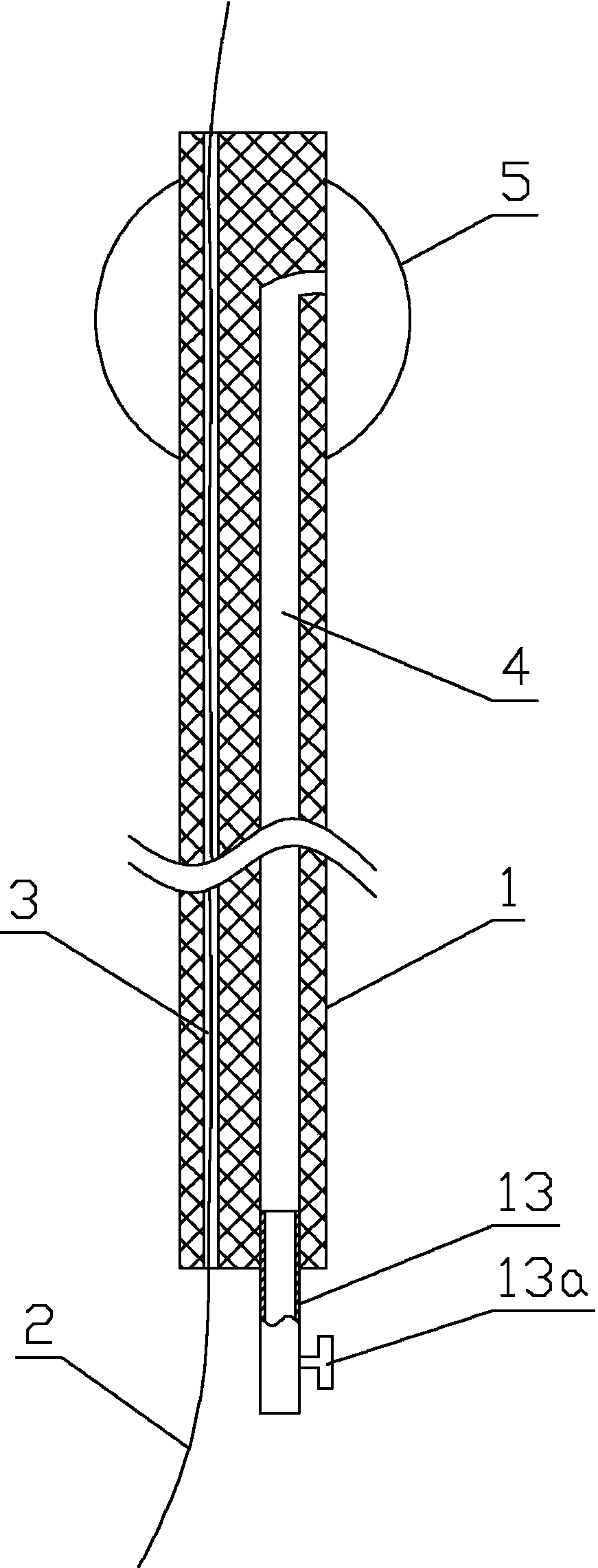 Embolectomy and thrombolysis device for visceral arterial embolism