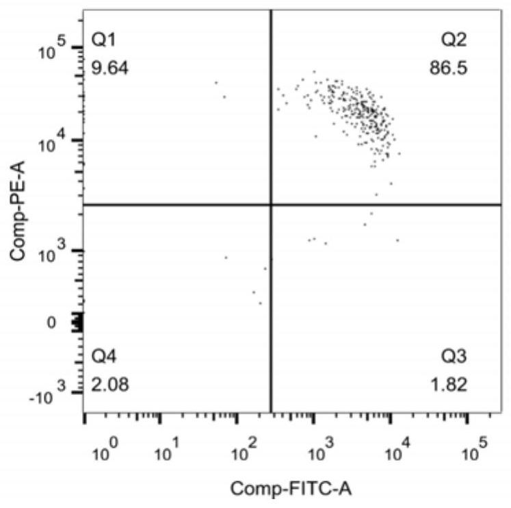 A kind of isolation and purification of mouse tumor tissue infiltrating CD4  <sup>+</sup> cd25  <sup>+</sup> regulatory t cell approach